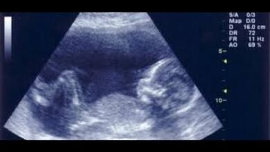 صورة حامل بالشهر الثالث كيف اعرف نوع الجنين باقل التكاليف واسهل الطرق